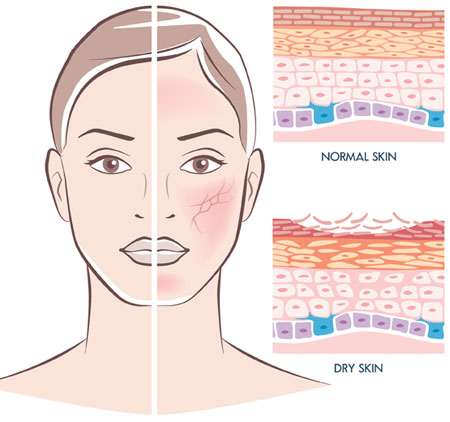 1510193769405471.jpg sci-skin-dry-illustration.jpg