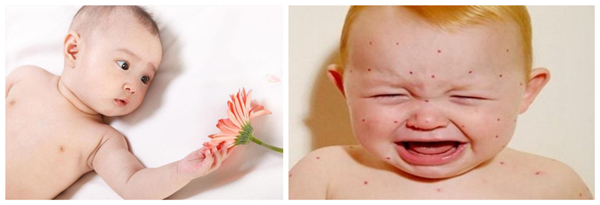 儿童湿疹反反复复，您有在家安装家用除湿产品吗？